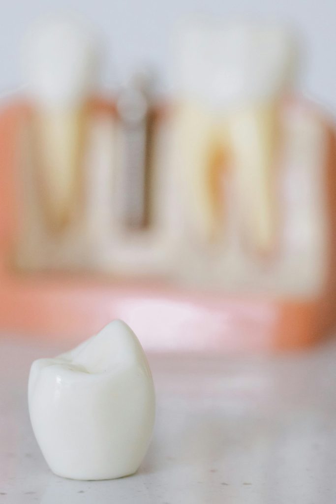 what are dental implants made of: the prosthetic crown