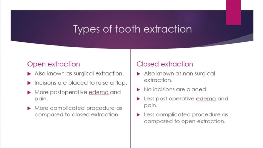 side by side comparison of the two types of tooth extraction