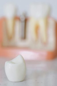 a permanent dental crown ready to fit in the patient's mouth